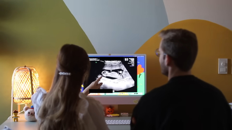PewDiePie and Marzia looking at ultrasound